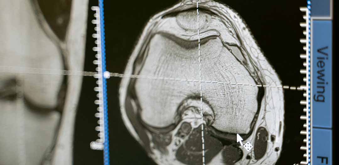 Medical X-ray machine used in imaging equipment for cooling pump motor application